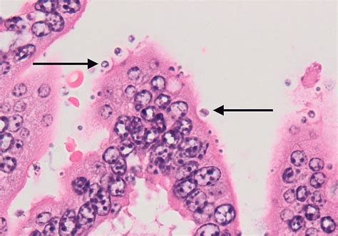  Kryptosporidium! Une menace microscopique pour les intestins des animaux et des humains