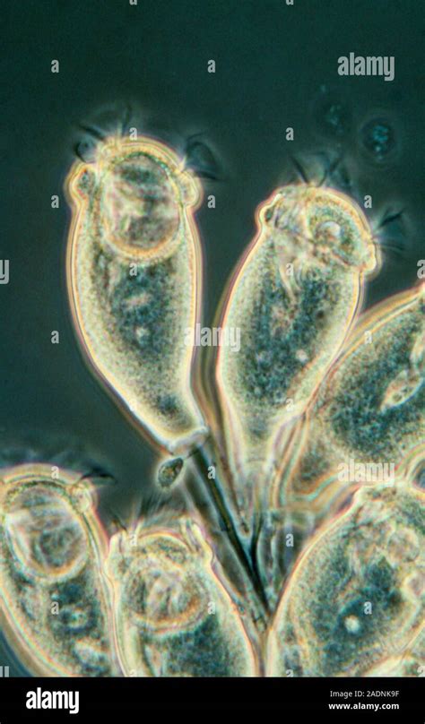  Zoothamnium: Découvrez un Cilié qui Dévoile les Secrets de la Microfaunes Aquatique!